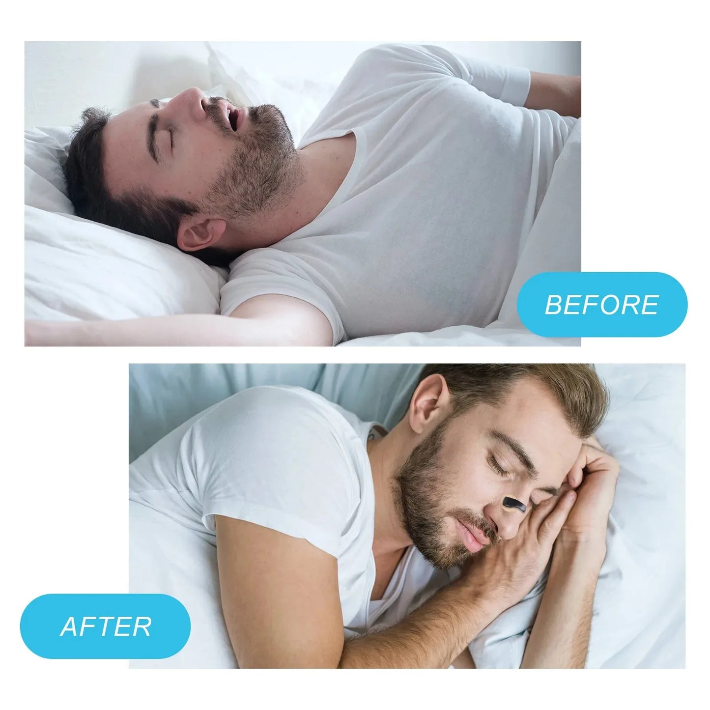 anti snoring device